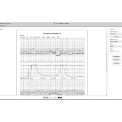 Logiciel PC MFM-CNS Lite pour cardiotocographe Edan F3