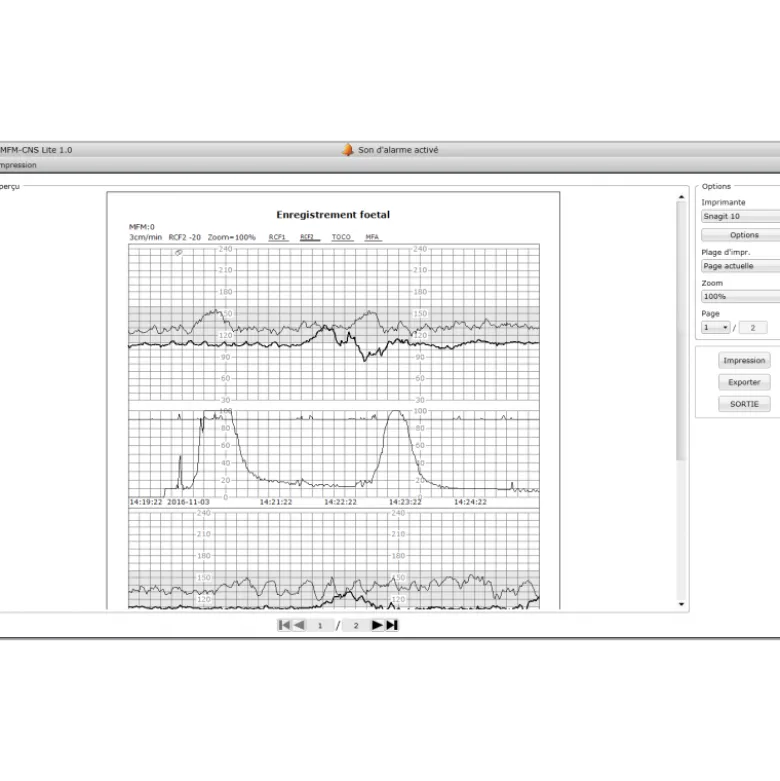 Logiciel PC MFM-CNS Lite pour cardiotocographe Edan F3