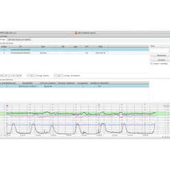 Logiciel PC MFM-CNS Lite pour cardiotocographe Edan F3
