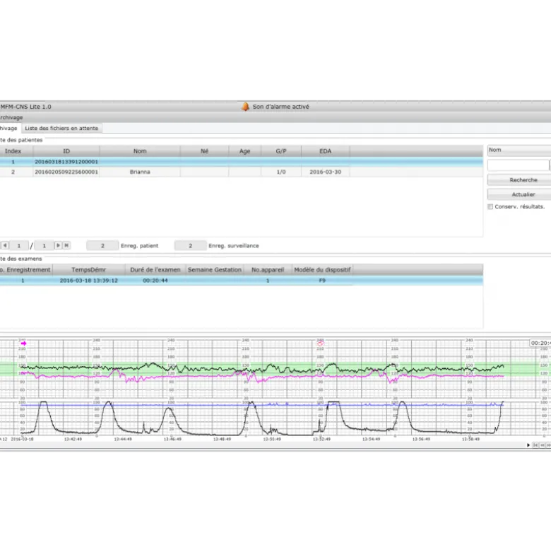 Logiciel PC MFM-CNS Lite pour cardiotocographe Edan F3