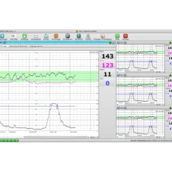 Logiciel PC MFM-CNS Lite pour cardiotocographe Edan F3