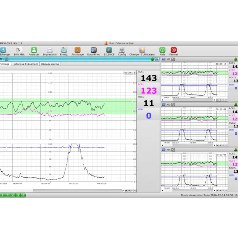Logiciel PC MFM-CNS Lite pour cardiotocographe Edan F3