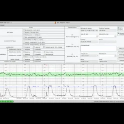 Logiciel PC MFM-CNS Lite pour cardiotocographe Edan F3
