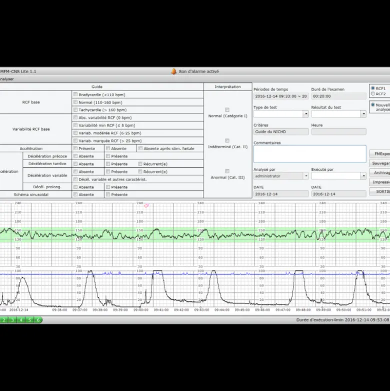 Logiciel PC MFM-CNS Lite pour cardiotocographe Edan F3
