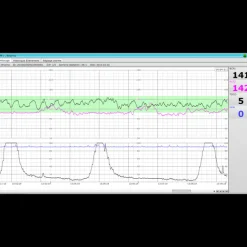 Logiciel PC MFM-CNS Lite pour cardiotocographe Edan F3
