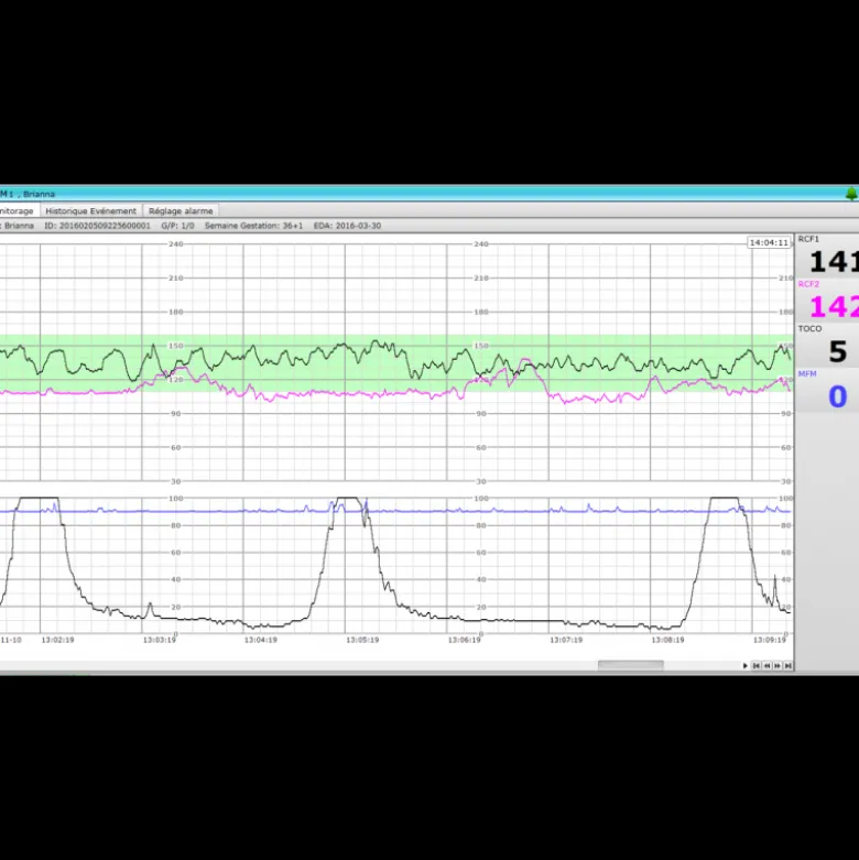 Logiciel PC MFM-CNS Lite pour cardiotocographe Edan F3