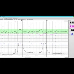 Logiciel PC MFM-CNS Lite pour cardiotocographe Edan F3