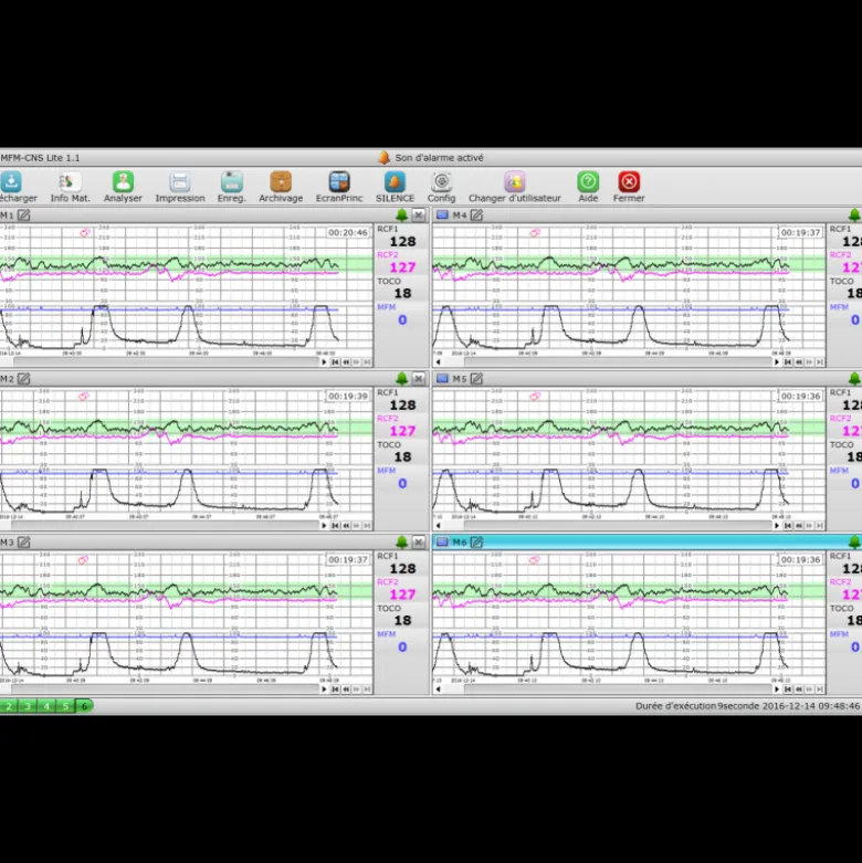 Logiciel PC MFM-CNS Lite pour cardiotocographe Edan F3