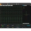 Logiciel SE-1515 pour ECG Edan