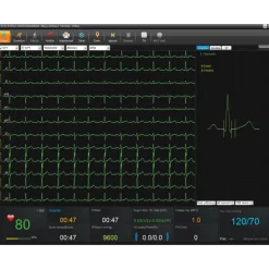 Logiciel SE-1515 pour ECG Edan