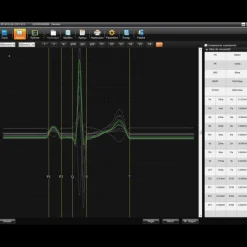 Logiciel SE-1515 pour ECG Edan