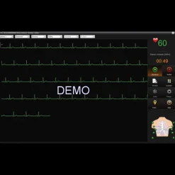 Logiciel SE-1515 pour ECG Edan