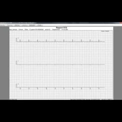 Logiciel SE-1515 pour ECG Edan