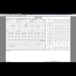Logiciel SE-1515 pour ECG Edan