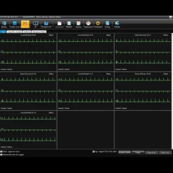 Logiciel SE-1515 pour ECG Edan