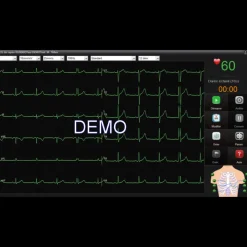 Logiciel SE-1515 pour ECG Edan