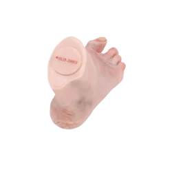 Modèle anatomique de pied diabétique au stade sévère Erler Zimmer
