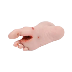 Modèle anatomique de pied diabétique au stade sévère Erler Zimmer
