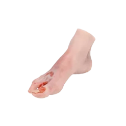 Modèle anatomique de pied diabétique au stade sévère Erler Zimmer