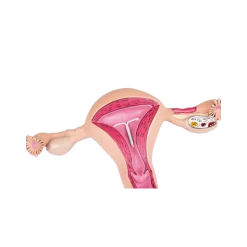 Modèle anatomique d'utérus sain Erler Zimmer