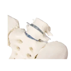 Modèle de bassin femme avec sacrum, vertèbres et cuisse Erler Zimmer