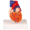 Modèle de coeur avec Bypass Erler Zimmer