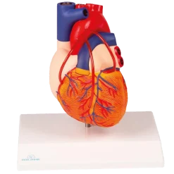 Modèle de coeur avec Bypass Erler Zimmer