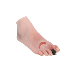 Modèle de pied blessé avec syndrome du pied diabétique Erler Zimmer