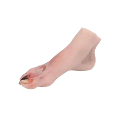 Modèle de pied blessé avec syndrome du pied diabétique Erler Zimmer