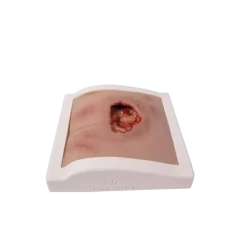 Modèle de plaie décubitus sacré nettoyé Erler Zimmer - Avec support