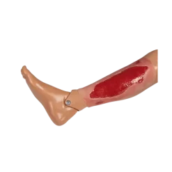 Modèle d'un ulcère artériel de la jambe en phase de granulation