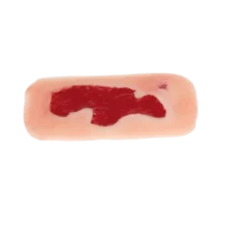 Modèle d'un ulcère artériel de la jambe en phase de granulation
