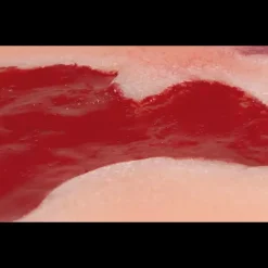 Modèle d'un ulcère artériel de la jambe en phase de granulation