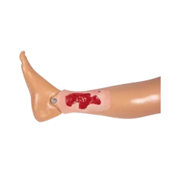Modèle d'un ulcère artériel de la jambe en phase de granulation