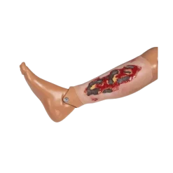 Modèle d'un ulcère artériel de la jambe en phase d'exsudation