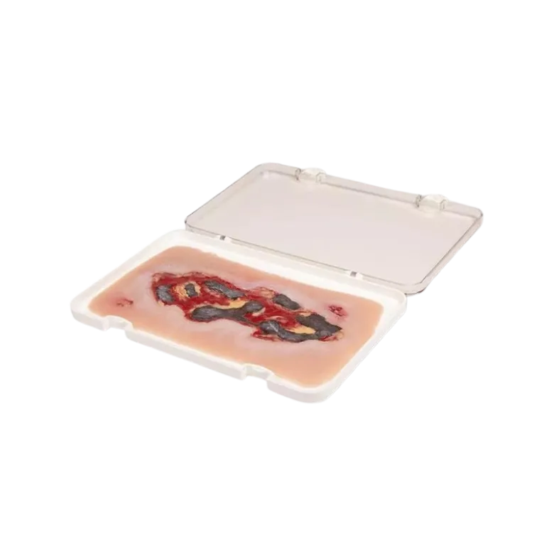 Modèle d'un ulcère artériel de la jambe en phase d'exsudation