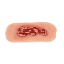 Modèle d'un ulcère veineux de la jambe en phase d'exsudation