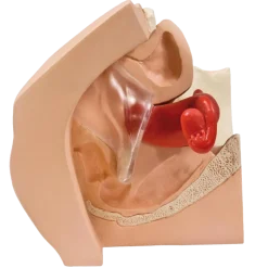 Modèle gynécologique P53 - 3B Smart Anatomy