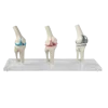 Modèles du genou Erler Zimmer (sain, malade, et avec implant)