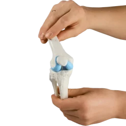 Modèles du genou Erler Zimmer (sain, malade, et avec implant)