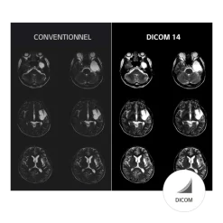 Moniteur d'affichage médical clinicien 8MP - 27