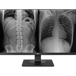 Moniteur d'affichage médical clinicien 8MP - 27