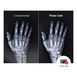 Moniteur d'affichage médical clinicien 8MP - 27