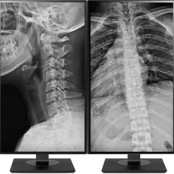 Moniteur d'affichage médical clinicien 8MP - 27