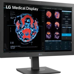 Moniteur d'affichage médical clinicien 2MP - 24" LG Electronics 24HR513C