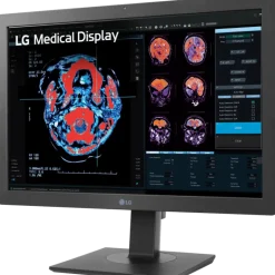 Moniteur d'affichage médical clinicien 2MP - 24" LG Electronics 24HR513C