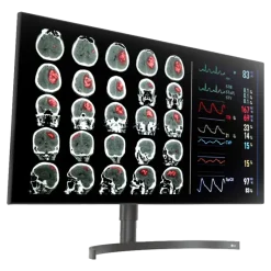 Moniteur d'affichage médical de diagnostic 8MP - 32" LG Electronics 32HL512D