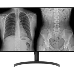 Moniteur d'affichage médical de diagnostic 8MP - 32