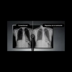 Moniteur d'affichage médical de diagnostic 8MP - 32
