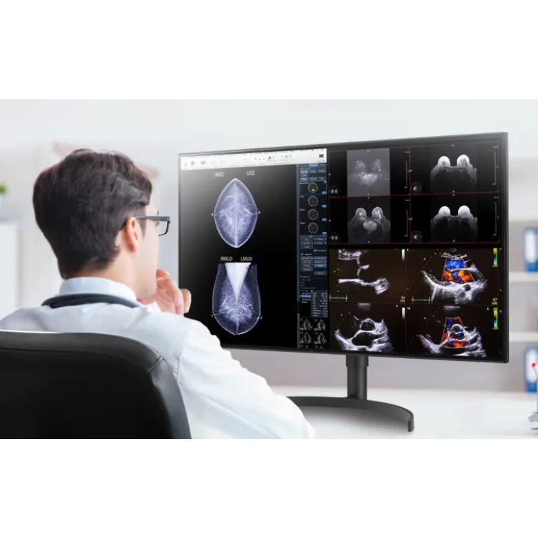 Moniteur d'affichage médical de diagnostic 8MP - 31.5" LG Electronics 32HQ713D